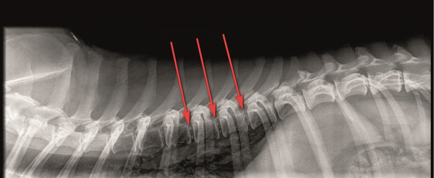 Røntgen af ryg pile viser forkalkninger